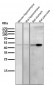 Anti-Cytokeratin 20 KRT20 Rabbit Monoclonal Antibody